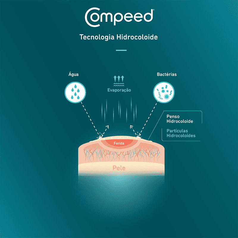 Compeed Hydrocolloid Technology Info graphic